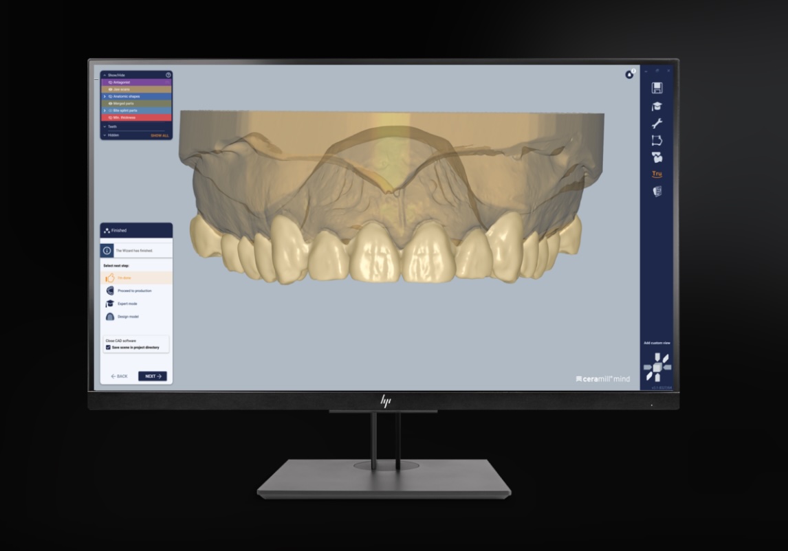 Ceramill Mind - conception num&eacute;rique