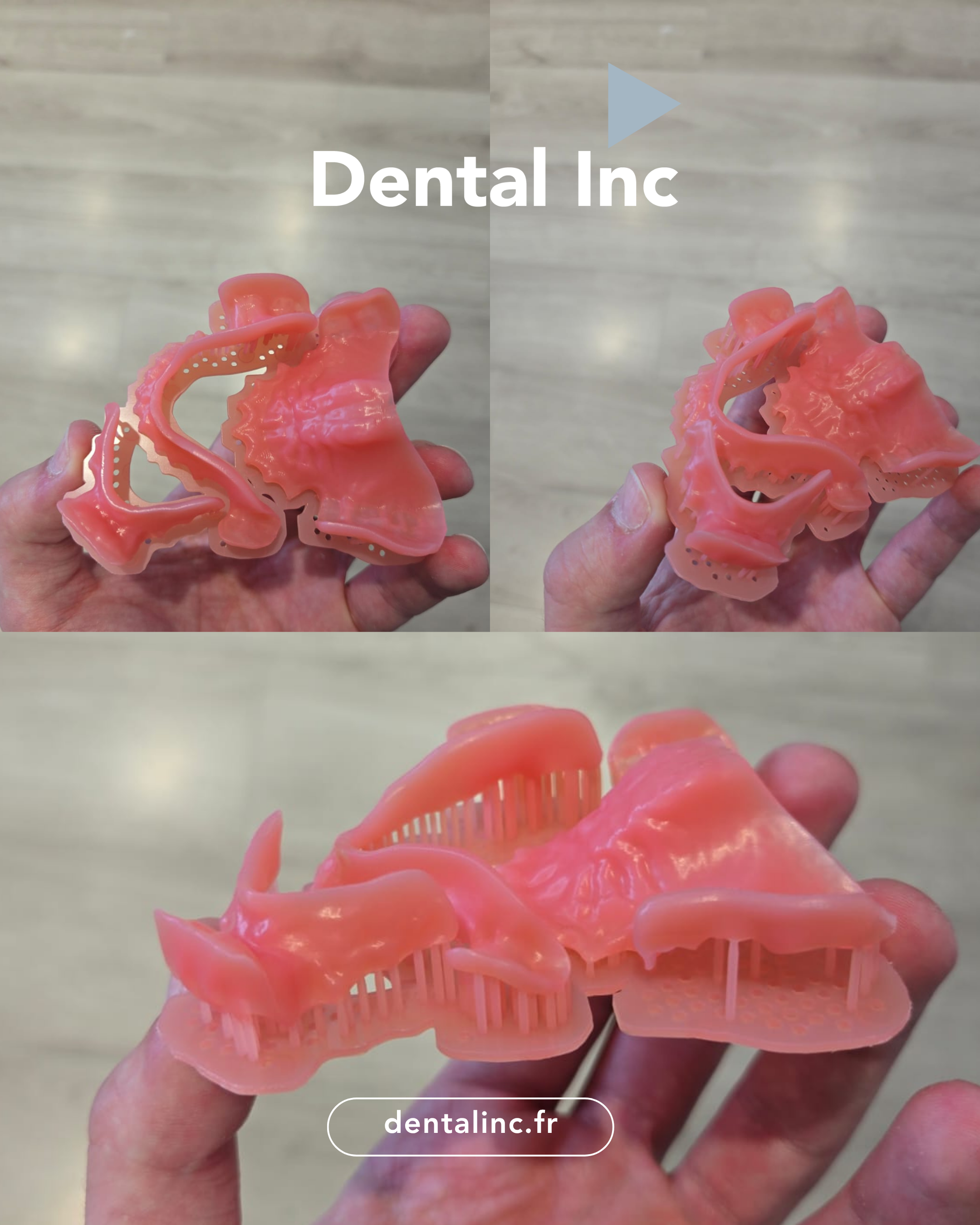 Ceramill-Motion-3_close-up(1000px)