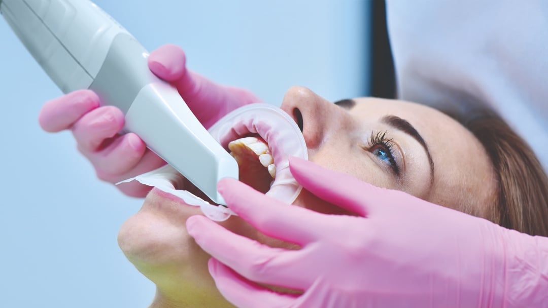 Empreinte optique au fauteuil — scanner intra-oral MyScan WL (NeoWise)