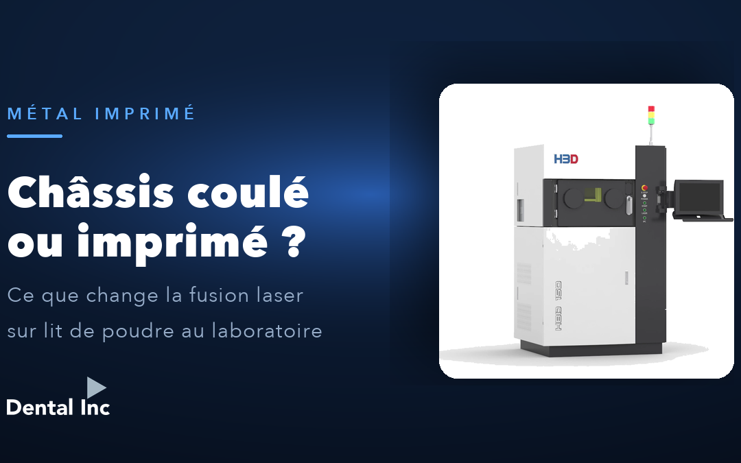 Châssis coulé ou imprimé en métal ? Ce que change la fusion laser